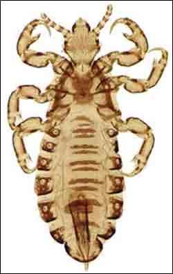 Male and female lice
