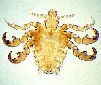 Phthirus pubis (crab, pubic louse) Found in pubic