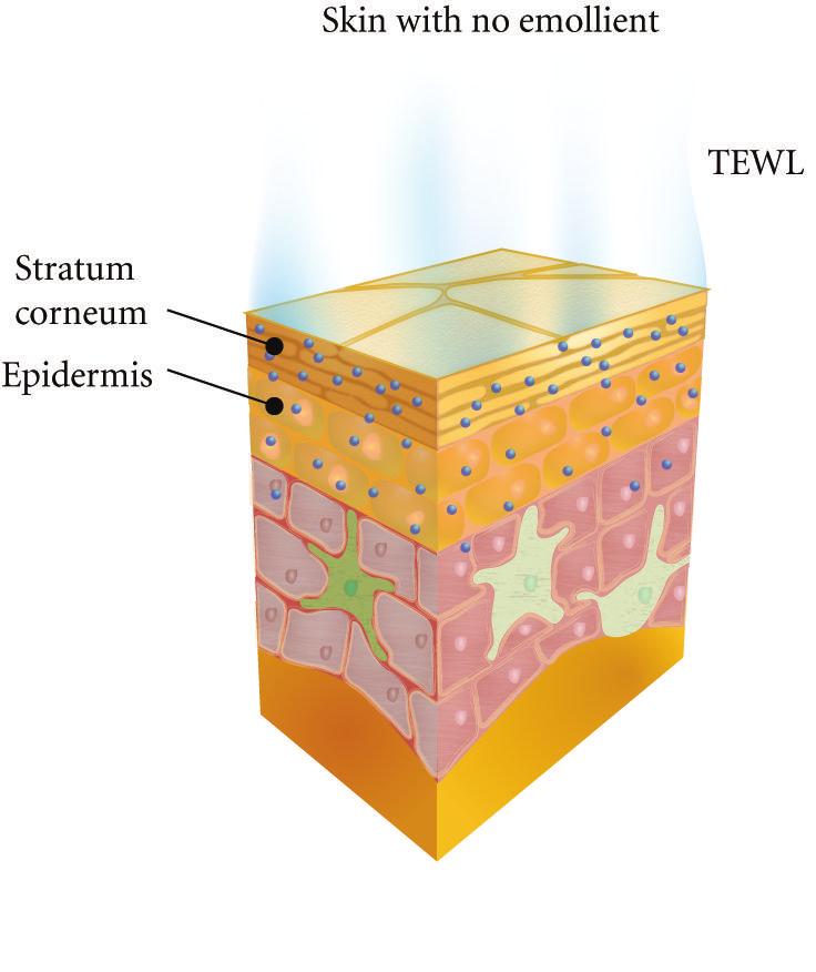 Dermatology Research and Practice 11 (a) (b) Figure 2: Stratum corneum (SC) moisture retention following application of mineral oil emollient.