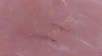 Depilatory Skin Integrity may cause allergic reaction Hair Residue Dissolved at or below skin surface Hair removal time Approximately 20 min including application & cleanup May become longer with