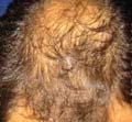 Factors of alopecia 1.