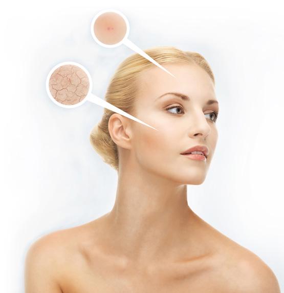 But as we age, our blood capillaries break down, blood flow weakens and less oxygen is delivered to the skin.