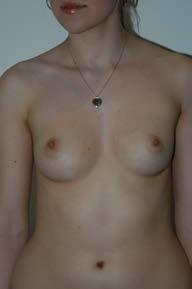 Please contact us for your consultation on breast