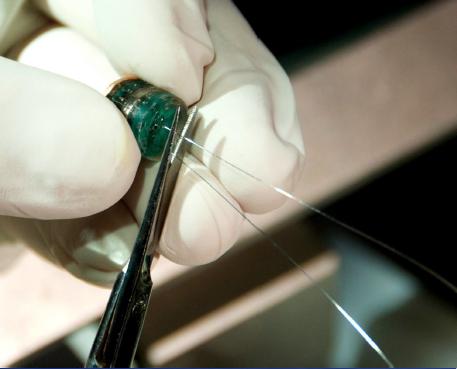 Trim Electrode Leads Use surgical scissors