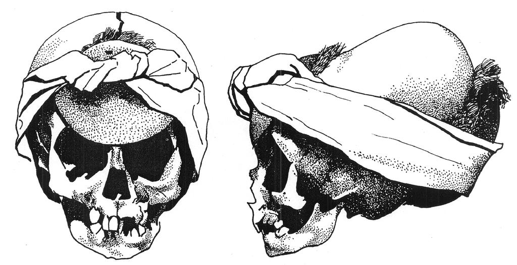 bones Flat-sided face vertical in profile Cheek