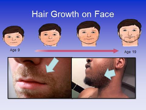 You may also grow hair on your chest and sometimes your back. This hair will also stay on your body.