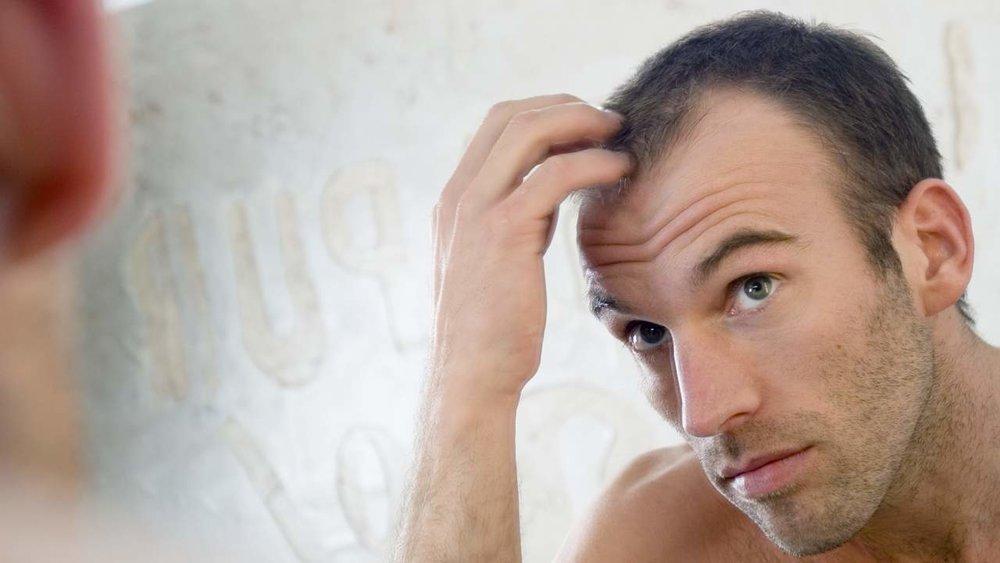 Men inherit baldness from their mother's side of the family Here's a little biology 101: If you're a man, your mother gave you an "X" chromosome and your father gave you a "Y." (Women receive two Xs.