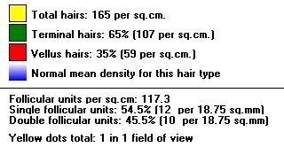 Hair diameter: Measured total: 31 hairs per 18.75 sq.