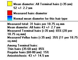 mm) Measured Vellus hairs (<35 µm): 35% (11 per 18.75 sq.