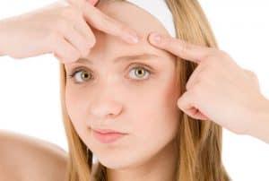 You can get acne on your forehead at any point in your life. It s a common, yet embarrassing problem as it looks unattractive and everybody can see it.