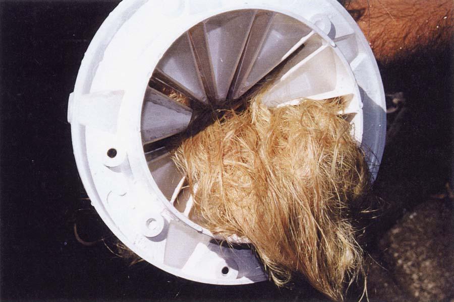 Figure 6 Underside of a suction cover after attempts to dislodge the tangled natural hair wig by pulling
