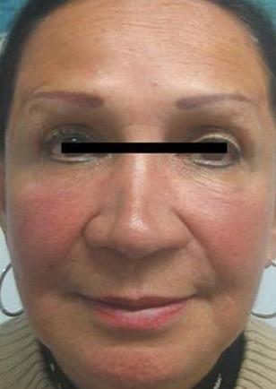 generate a complete facial
