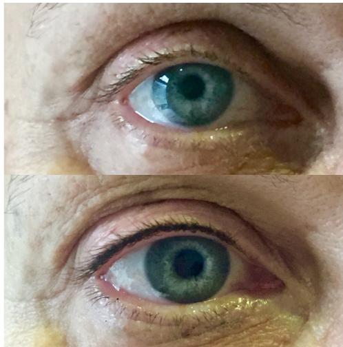 Semi Permanent Make Up Also known as micropigmentation, semi permanent make up procedures have been successfully undertaken for many years by both celebrities and busy women,
