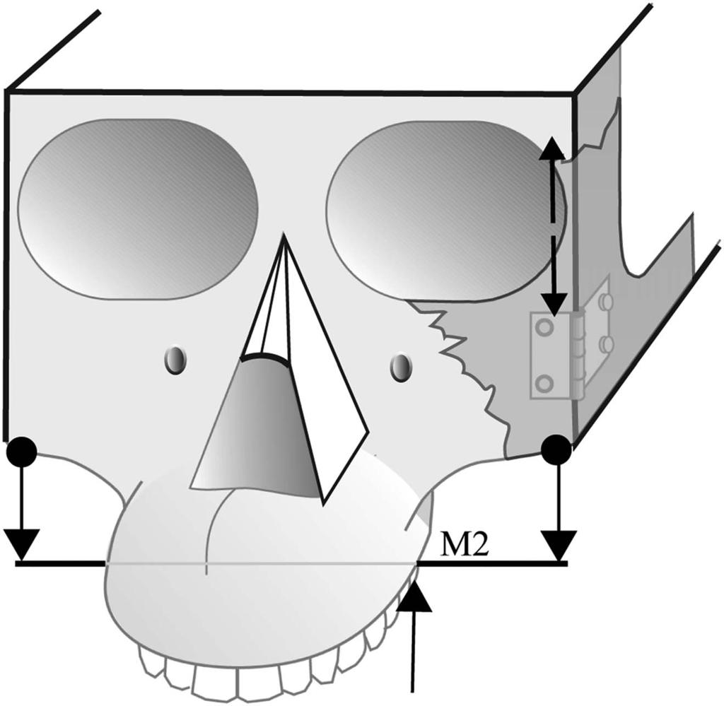 OPPOSING EXTREMES OF ZYGOMATIC MORPHOLOGY 153 Fig. 1. A schematic representation of the generalized primate face. zygomatic arch (Fig. 1).