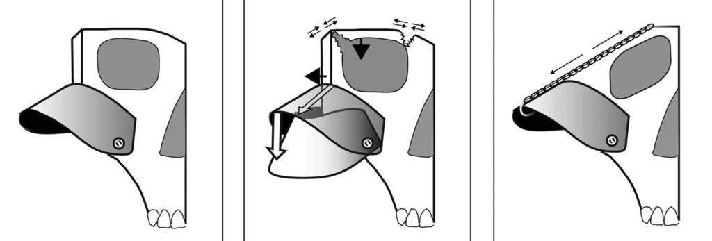 OPPOSING EXTREMES OF ZYGOMATIC MORPHOLOGY 155 Fig. 2. The transformation of the zygomatic bone into a self-supporting visor-like structure.
