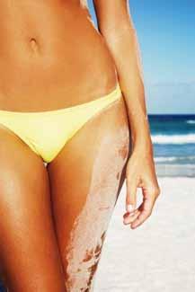 95 Intimate waxing Californian 16.50 Brazilian 28.95 Hollywood 29.95 Bikini Hair colouring P.O.A Male waxing - please ask for our separate brochure Threading Eyebrows 9.95 Lip 9.95 Lip & Chin 15.