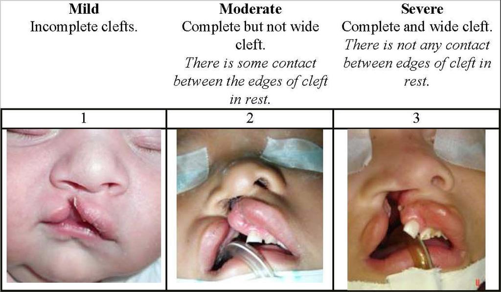 burden, without solving the real obstacles in the clinical research of cleft lip and palate treatment.