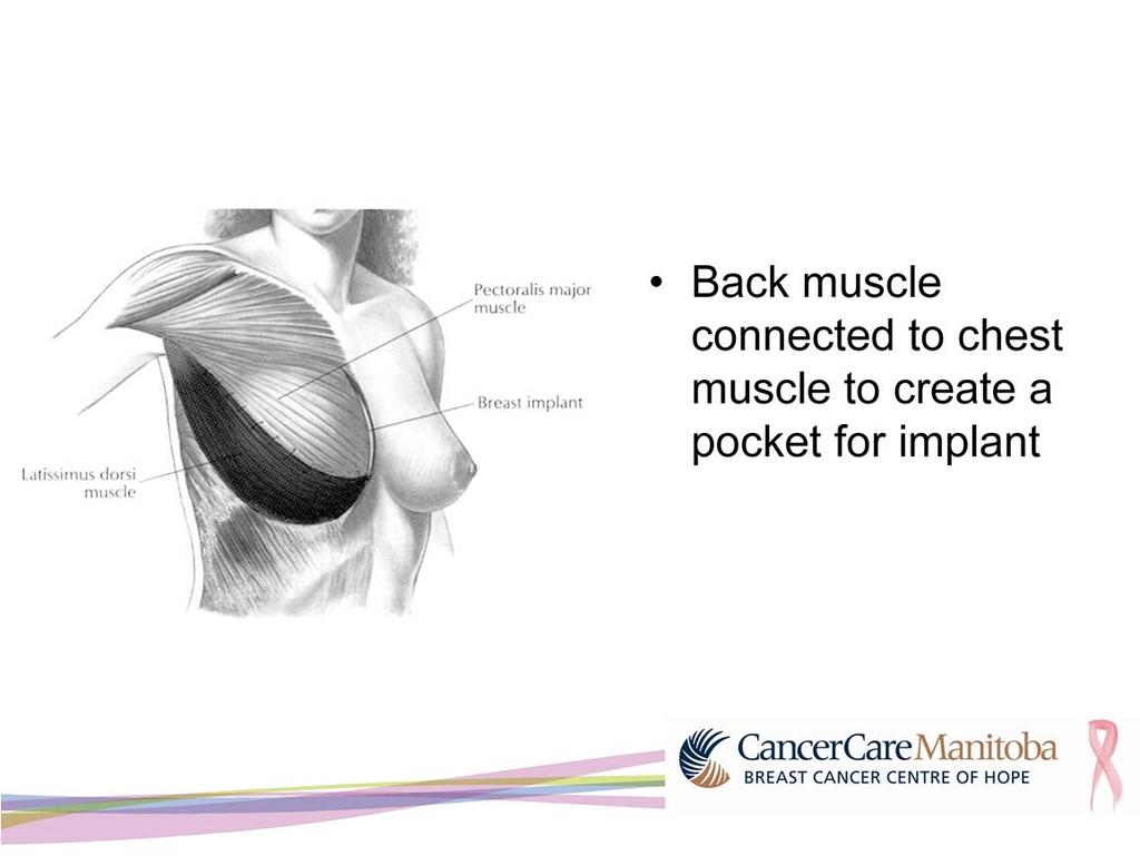 The back muscle is tunneled under the armpit and connected to the chest muscle called the pectoralis major.