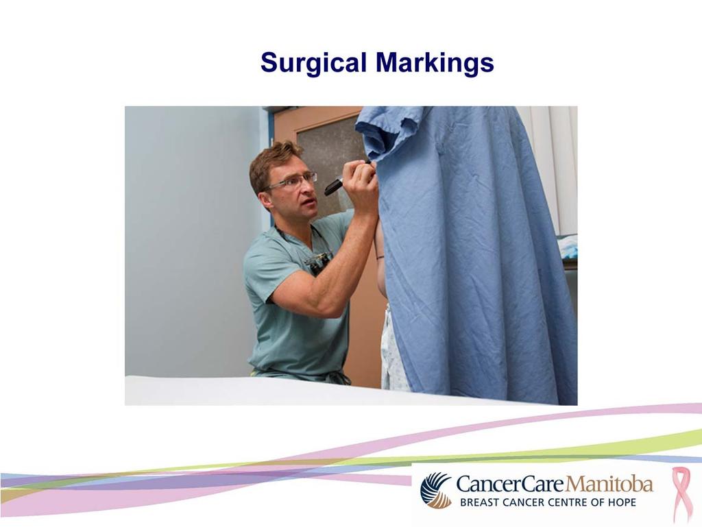 Before your surgery, your surgeon will have placed surgical markings on your skin with a black marker. This is done in the pre-op area before going into surgery.