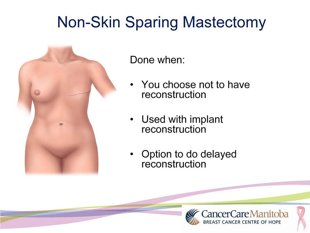 The first type of mastectomy is a non-skin sparing mastectomy.