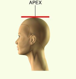 The Apex is the highest point on the top of the head.