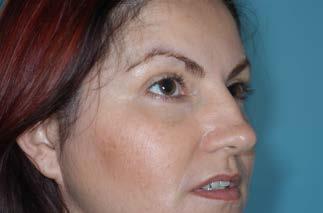 au Information on a range cosmetic surgery and non surgical cosmetic procedures available