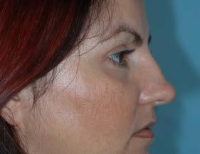 Fees and Private Health Insurance rebate If you wish to learn more about cosmetic surgery and