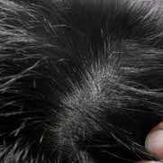 MALASSEZIA Malassezia is a yeast-like fungus that lives on the scalp of all individuals and typically does not cause problems.