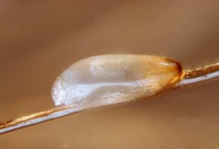Lice eggs have curved walls and will pop when squeezed Dead