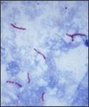 This photomicrograph reveals Mycobacterium tuberculosis