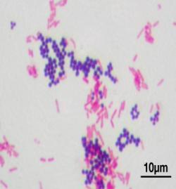 stain Structural
