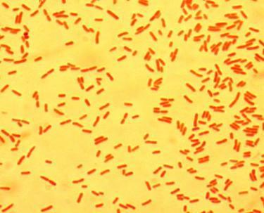Escherichia coli Name of stain Direct stain Direct stain Type of stain