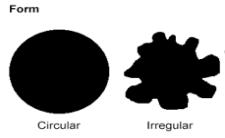 Results 7 1- Shape: (Circular-irregular). 2- Size: -Small (pinpoint).