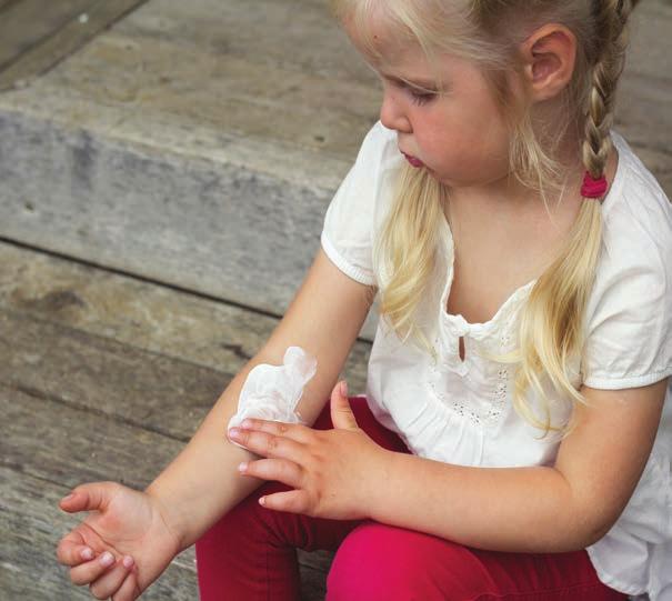 Long-term conditions: atopic eczema Atopic eczema and emollients: guidance for GPNs Pe op le Lt d Atopic eczema is a common dry skin condition, and, as with any dry skin condition, emollients are a