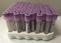 Blood Sampling Procedure A veterinarian Purple topped EDTA tubes Ice packs for shipping 1. Request your veterinarian to collect at least 1 ml blood in a purple topped vacutainer test tube with EDTA.