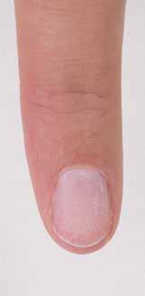 .. The natural nail should always be properly prepared but if you aim to pinch nails it is important to understand how the natural nail will react.