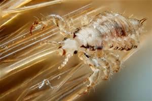 What parents should know about head lice Head lice, though common still make parents, teachers and health care workers