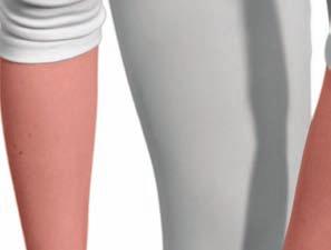 ABOUT READYWRAP ReadyWrap is an alternative to stard elastic long-stretch hosiery that works with your natural