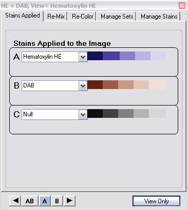 Creating and Modifying a Stain Set Identify Stains Used on the Digital Slide The list of stains provided by IQ give good approximations of the color definitions for those stains, but may not
