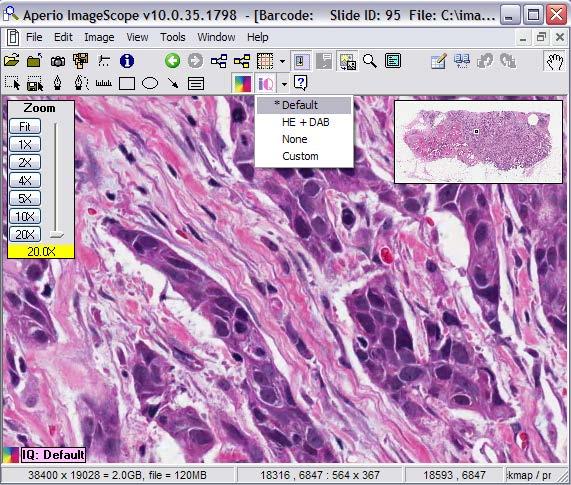 Viewing Images with Image Quality Image Quality (IQ) Customize the view of digital slides using IQ enhancement features to: Digitally adjust the stain colors.