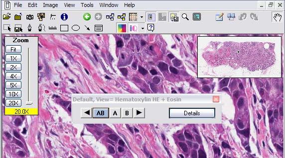 Viewing Images with Image Quality IQ Features View a selected stain as you navigate the