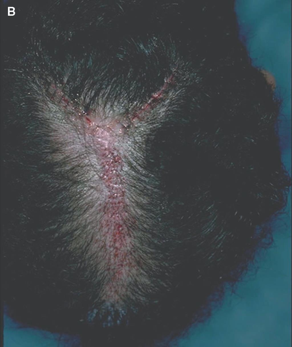 medications that interfere with healing can also result in unacceptable scars.
