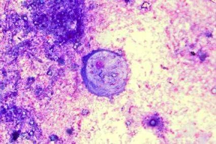 BACKGROUND PINK PALE BLUE Identification of protozoa
