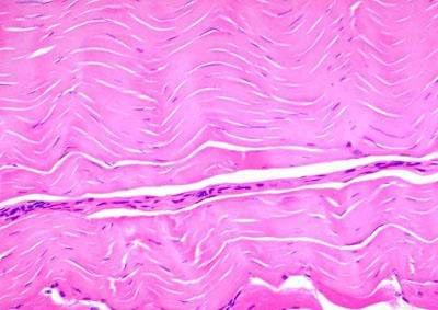 Cellular portion consists of fibroblasts, mast cells, histiocytes, adipose cells, reticular cells, osteocytes,