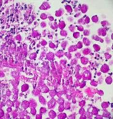 SPECIAL STAINS IN HISTOLOGY