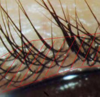 Evaluation of the lash density Lash density : number of roots per unit of surface 1 At