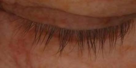 Evaluation of the lash