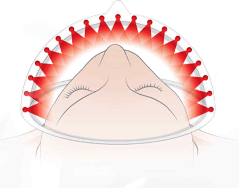 M ILUX Benefits Be closer to the skin SPECTRUM MASK W ithout excessive glare and burns Existing high-power LED beam therapy sometimes may occur problems such as excessive glare and a lowtemperature