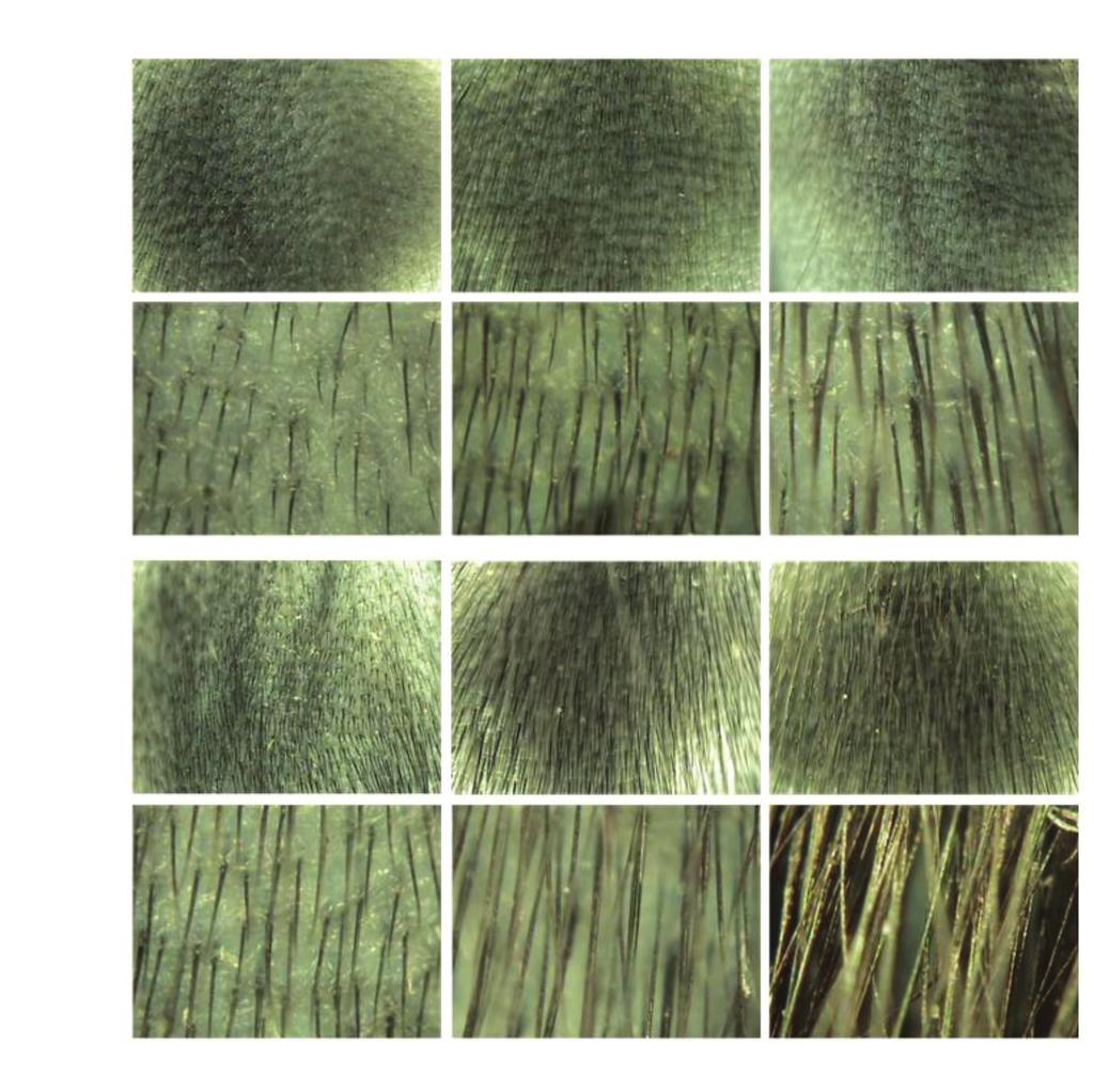 The thicknesses of the shafts of the re-grown hair were greater in the mice treated with and the mice treated with Minoxidil (negative control) than they were in the mice treated with normal saline