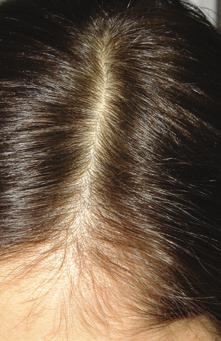 BEFORE AFTER BEFORE AFTER Dr Saranghi courtesy Dr Saranghi courtesy Hair TD New energy for